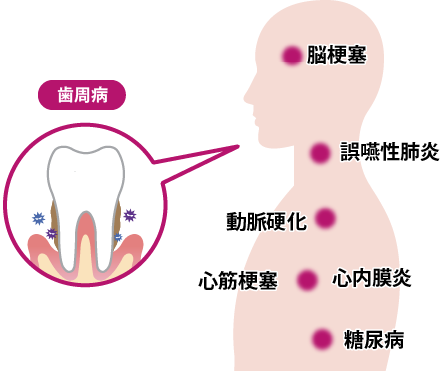 t01